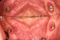 implant-dumfries-2-scaled