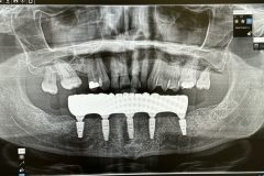 implant-dumfries-3-scaled